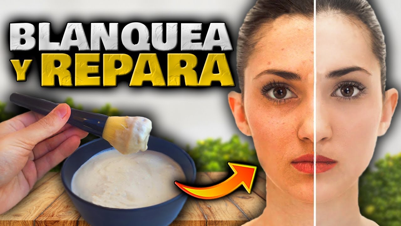 como blanquear la piel naturalmente y rapido con remedios caseros
