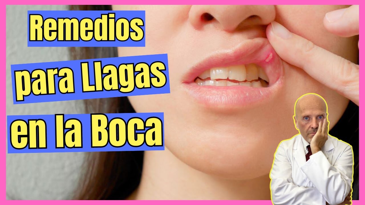 como curar las llagas en la boca de forma natural