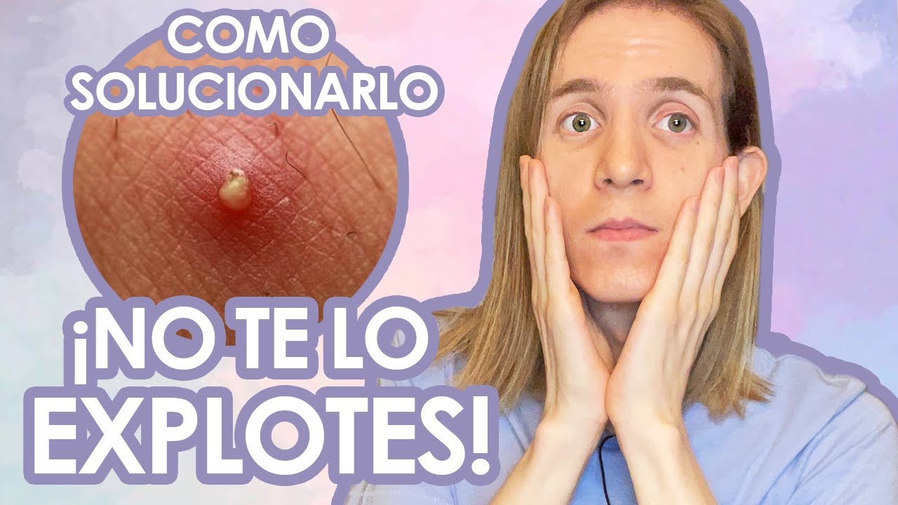 como quitar granos dela cara sin dejar marca