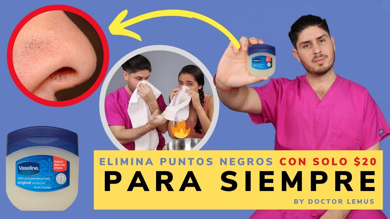 como quitar los puntos de la nariz con vapor