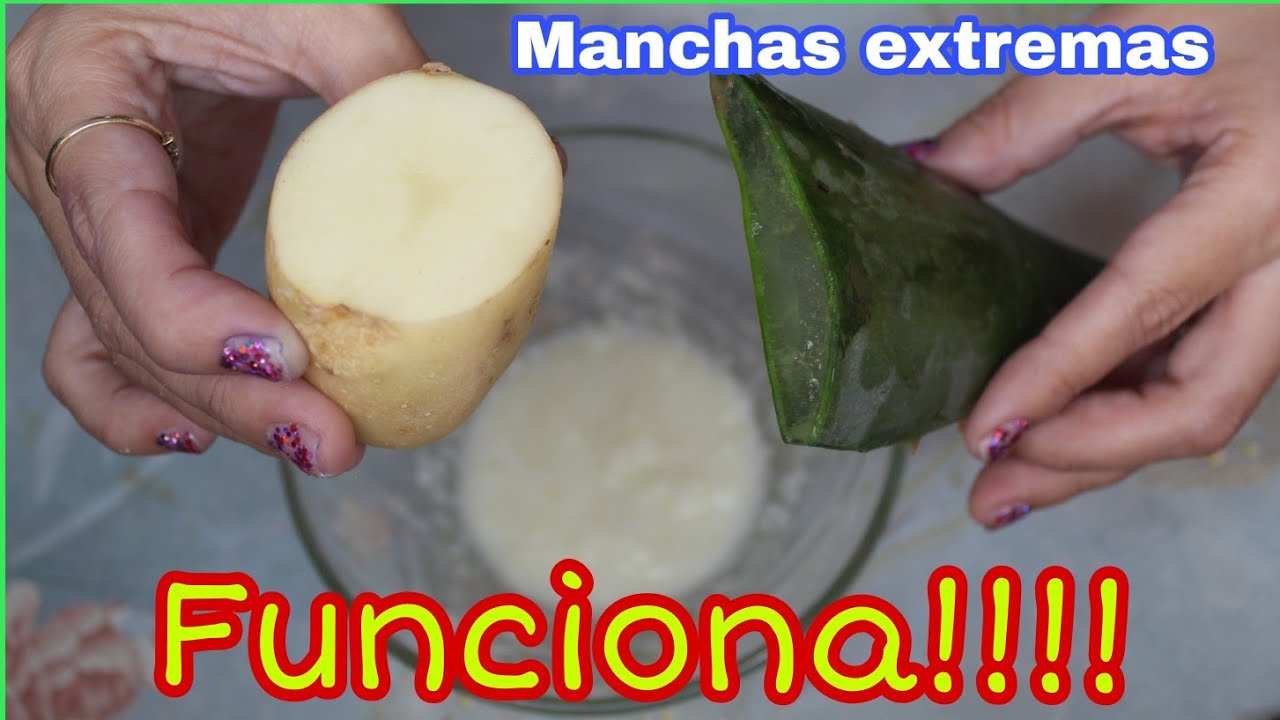como quitar manchas en la cara por quemaduras