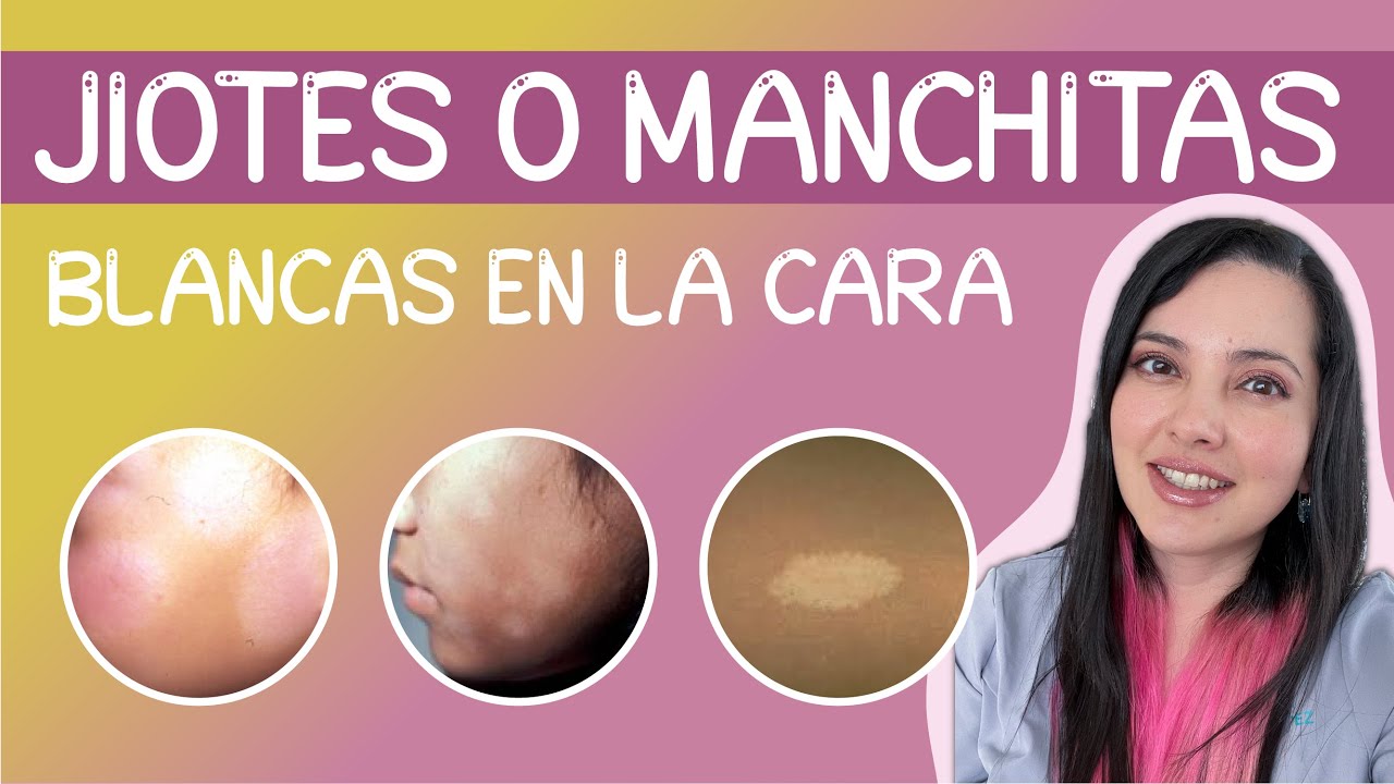como quitar una mancha blanca en la cara