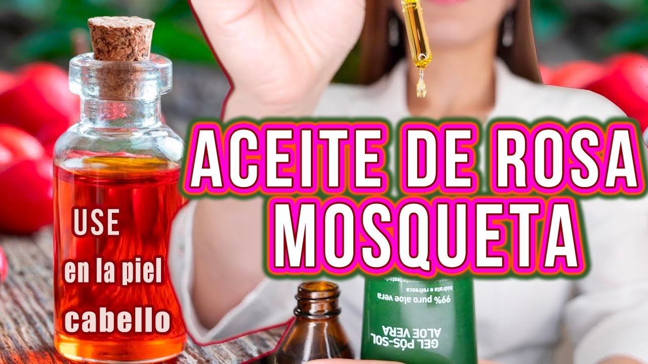 el aceite de rosa mosqueta quita las estrias