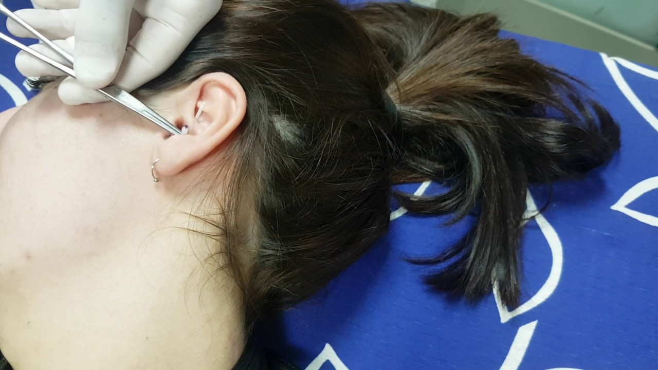 en que oreja se hace el piercing daith