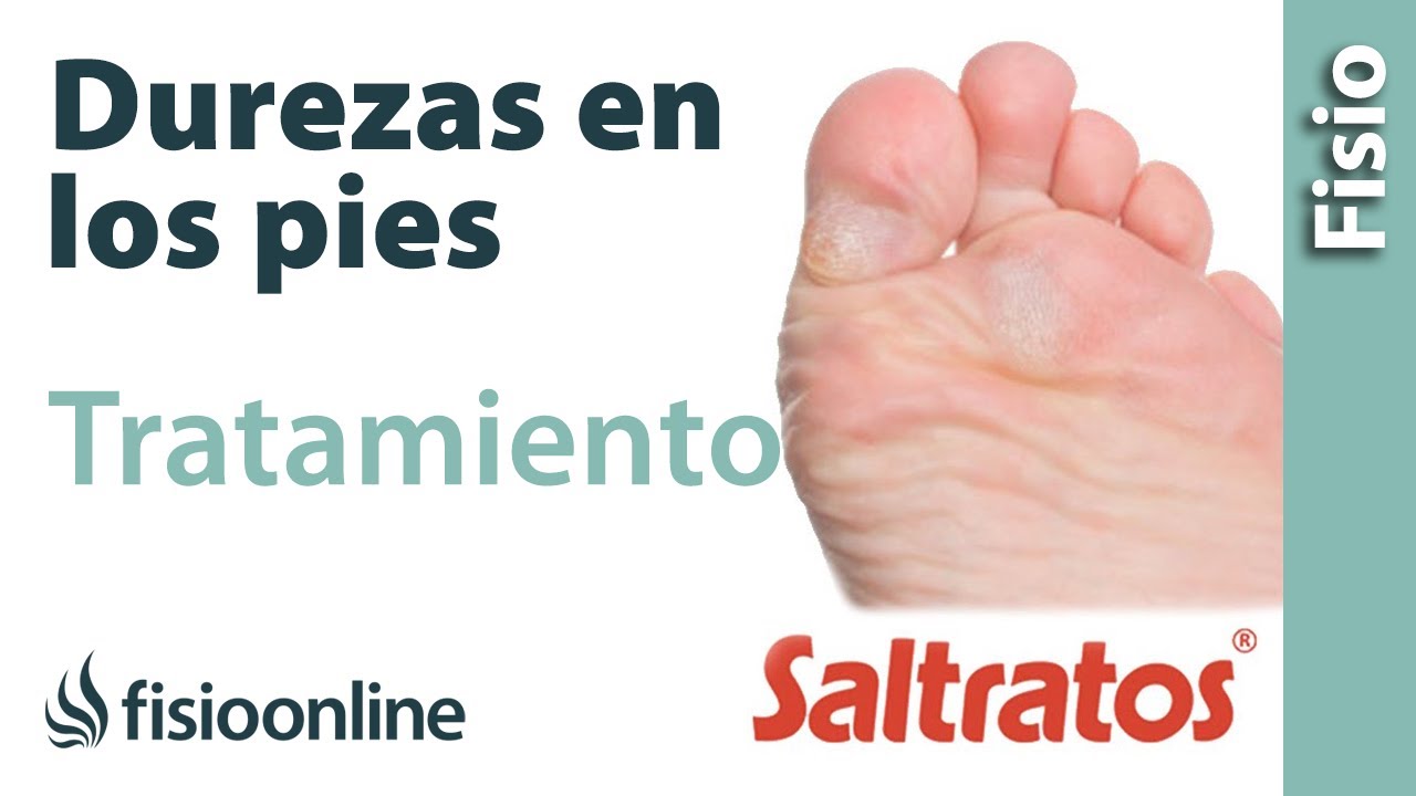 tratamiento para callos en la planta del pie