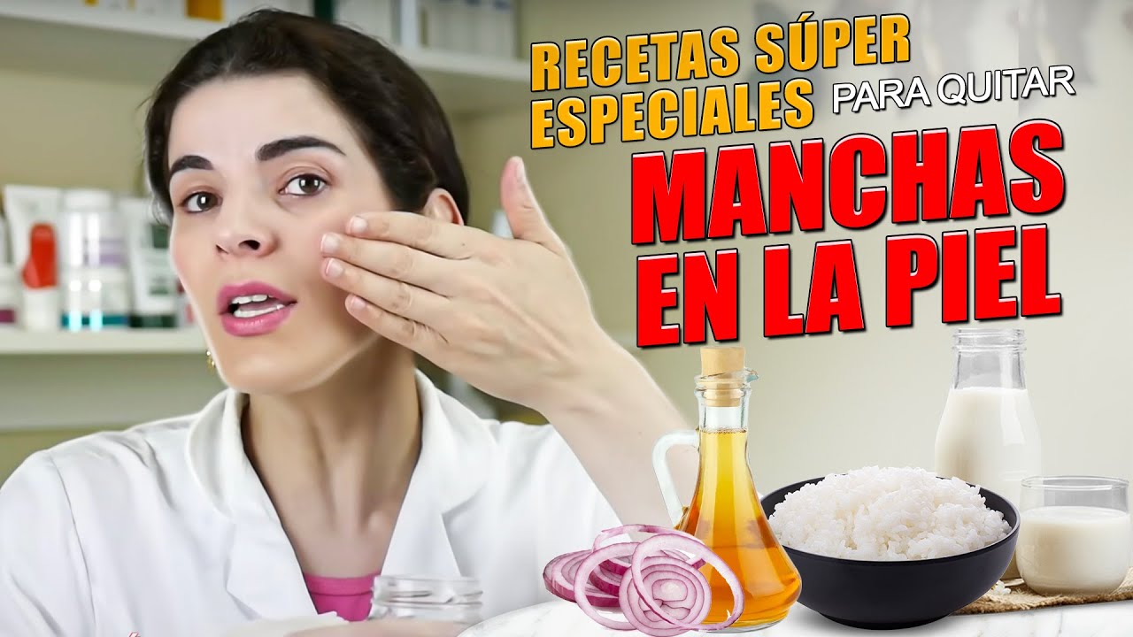 como quitar las manchas oscuras dela cara en una semana