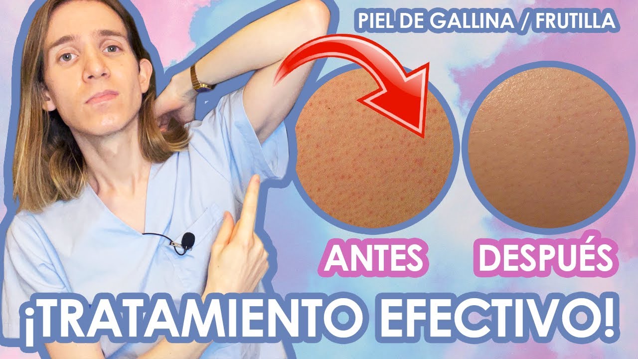 como quitar los poros rojos de las piernas