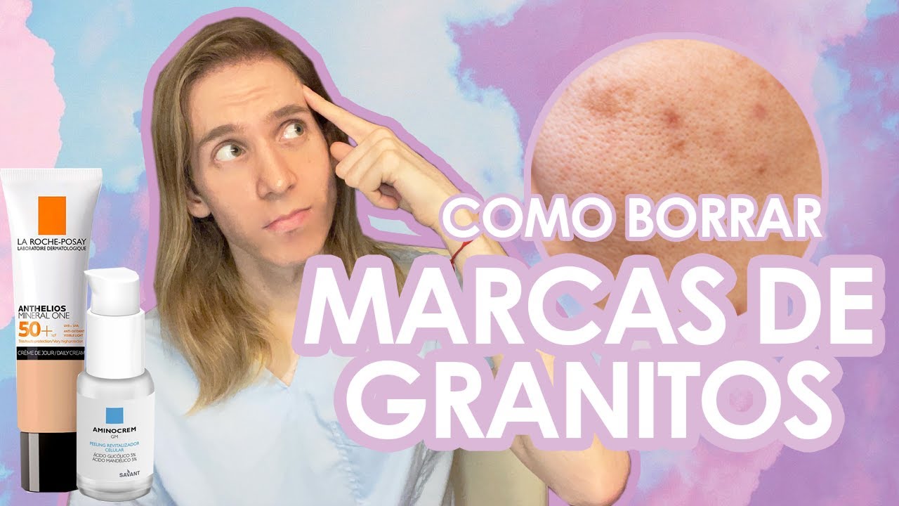 como quitar manchas en la piel por acne