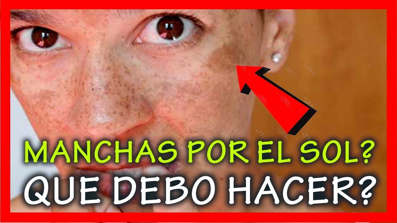como se quitan las manchas de sol en la cara