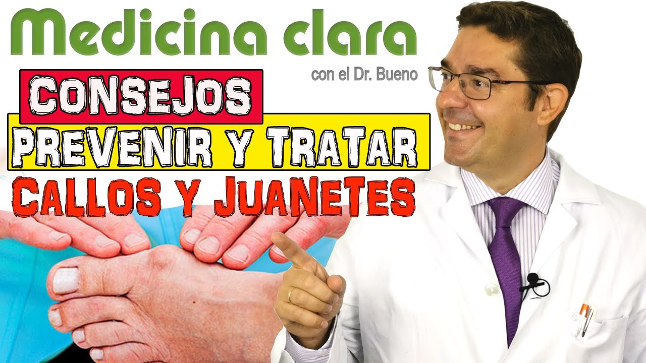 como tratar los callos de la planta delos pies