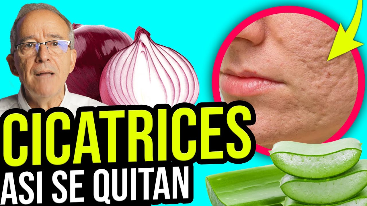que es bueno para las cicatrices en la cara