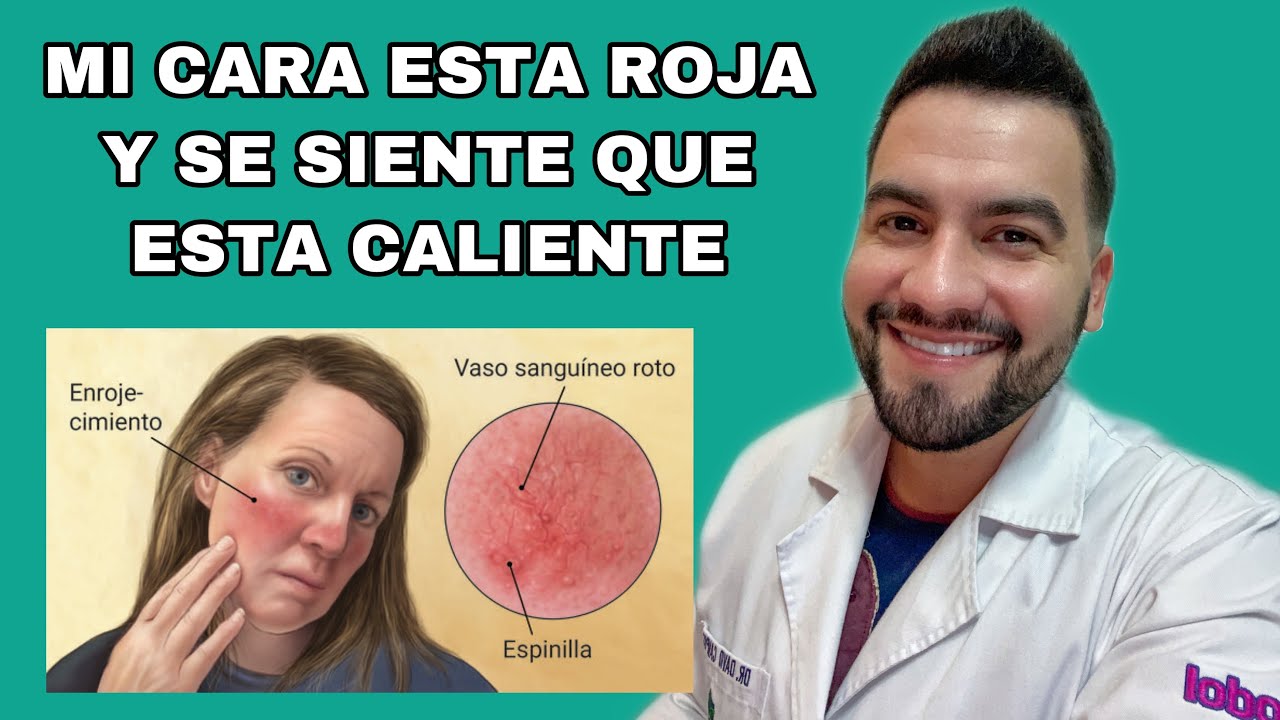 rojeces en la cara al salir de la ducha