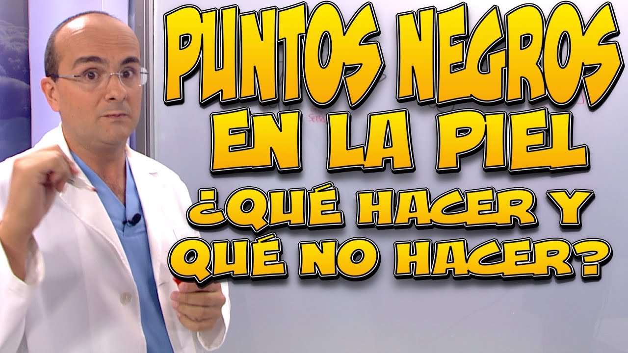 porque salen los puntos negros en la cara